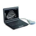 PT3000d1 Laptop Full Digital Ultrasound